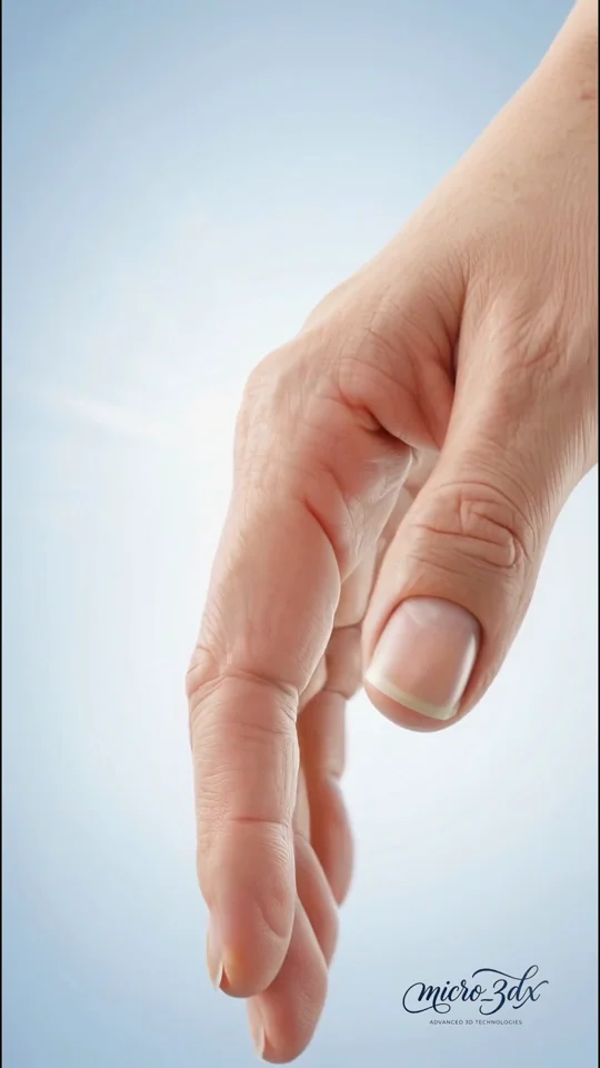 Frame from Nail fungus
