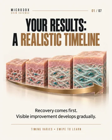 Microneedling: the results timeline — actual first slide