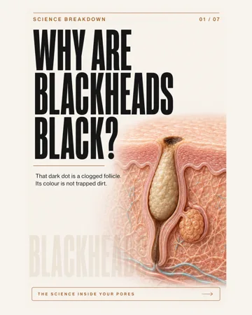 Why are blackheads black? — actual first slide